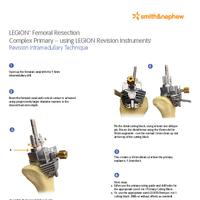 LEGION Femoral Resection Complex Primary Surgical Technique Addendum