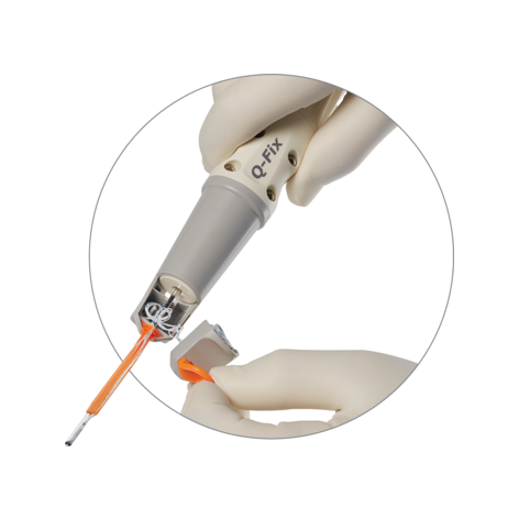 Q-FIX with Needles All-Suture Anchor for joint repair