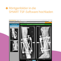 SMART TSF Hardware Pocket Reference Guide