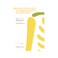 Arthroscopic Latarjet TG Taverna_Castricini 25434-it V4 0620