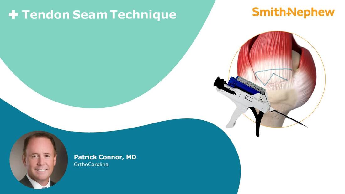 TENDON SEAM Surgical Technique featuring Dr. Connors