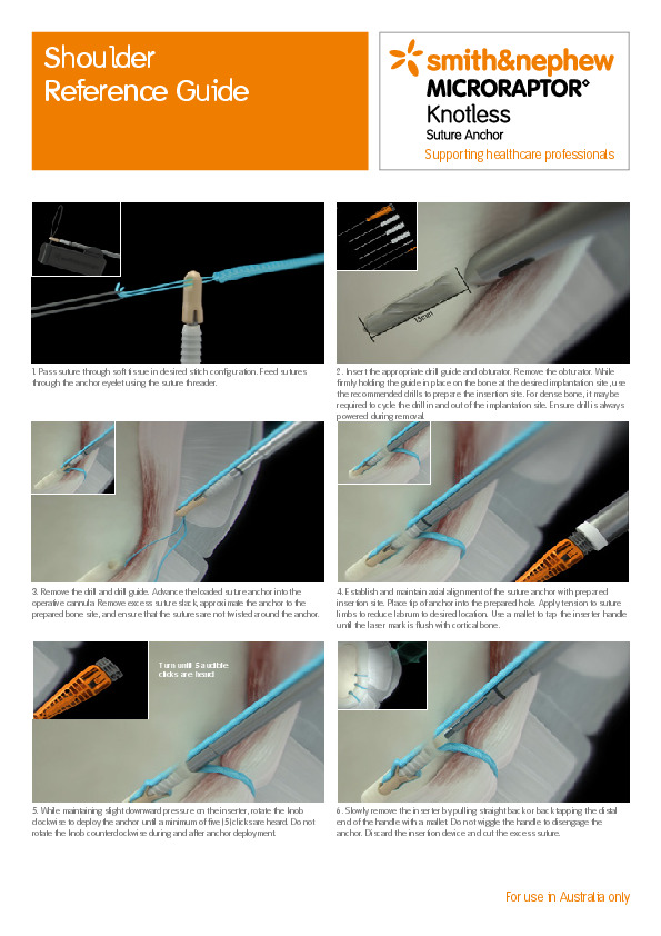 MICRORAPTOR KNOTLESS Shoulder Reference Guide (AU)