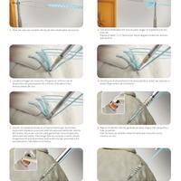 22198-es EMEA V4 HEALICOIL Knotless RefGuide Self Tapping 0920