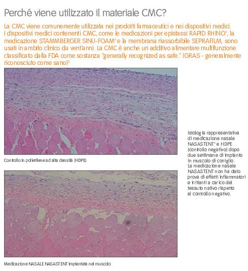 60081A-it S&N NASASTENT Product Brochure.pdf