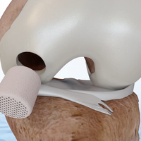 Smith+Nephew acquires novel cartilage regeneration technology for sports medicine knee repair