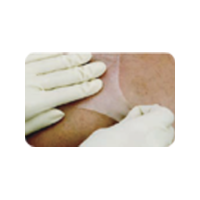 OPO How to Remove Thumbnail