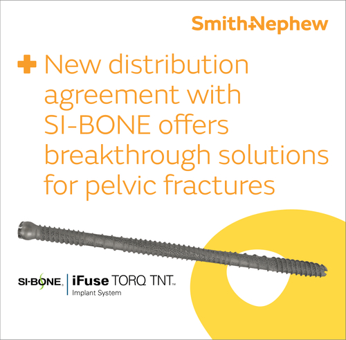 SI-BONE iFuse TORQ TNT.jpg