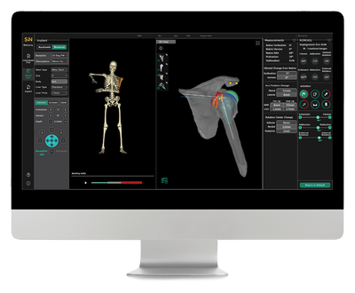 CORIOGRAPH Shoulder Main Body Image