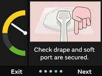 RENASYS EDGE_PATIENT web page_CHECK-DRAPE