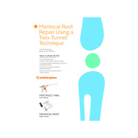 05486 FIRSTPASS MINI surgical technique en