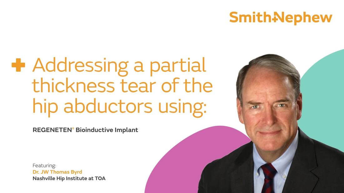 Addressing a partial thickness tear of the hip abductors using REGENETEN featuring Dr. Byrd