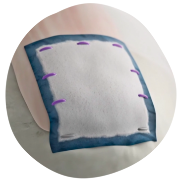 Image of the Smith+Nephew REGENETEN Implant, used to support tendon strength and recovery in rotator cuff repair.