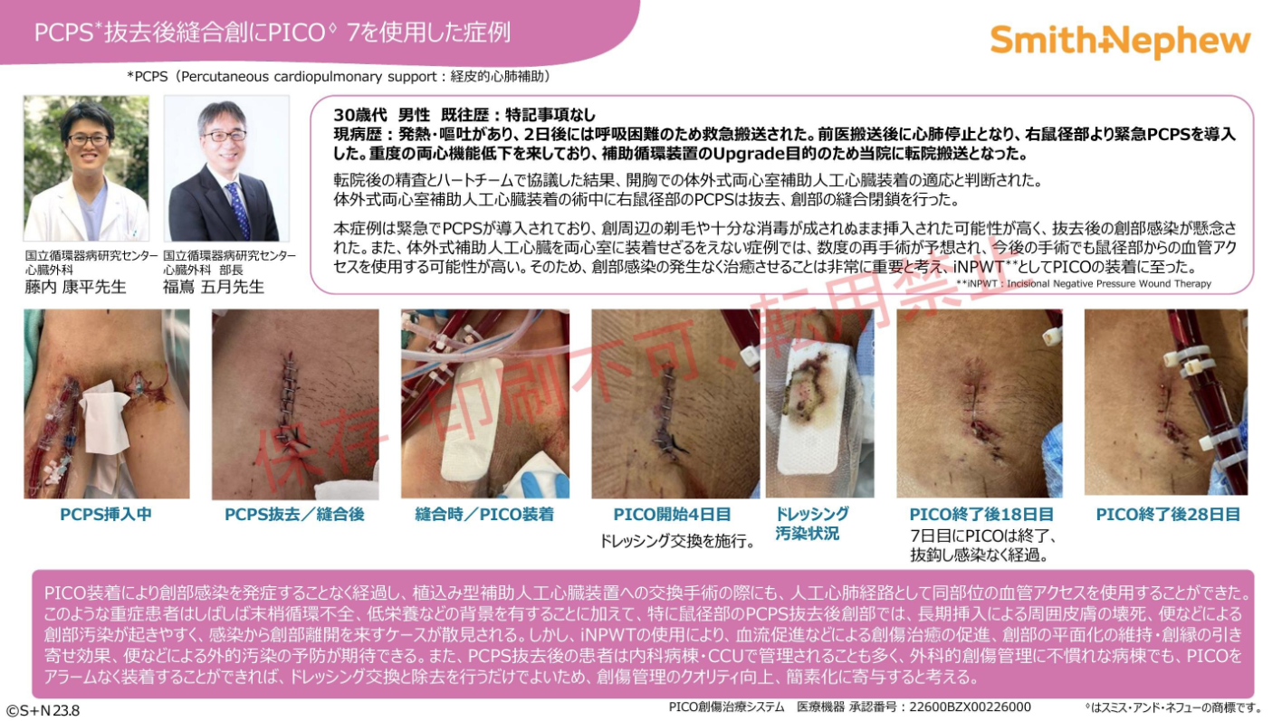 Cacereportサムネ1.png