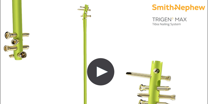 TRIGEN MAX for PR.jpg