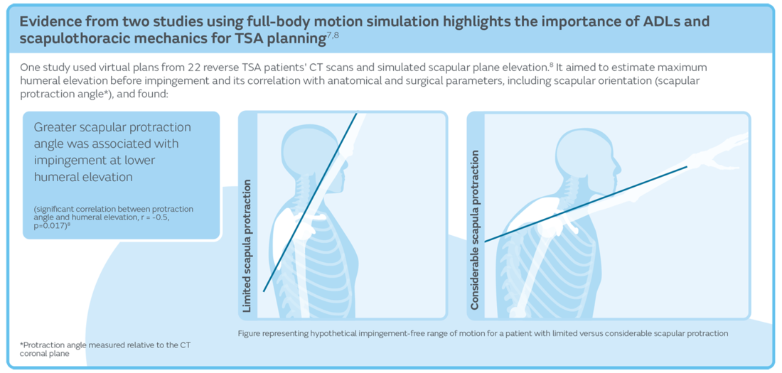 48688 V1 CORIOGRAPH Shoulder EiF Blog Graphic 4 0426.png
