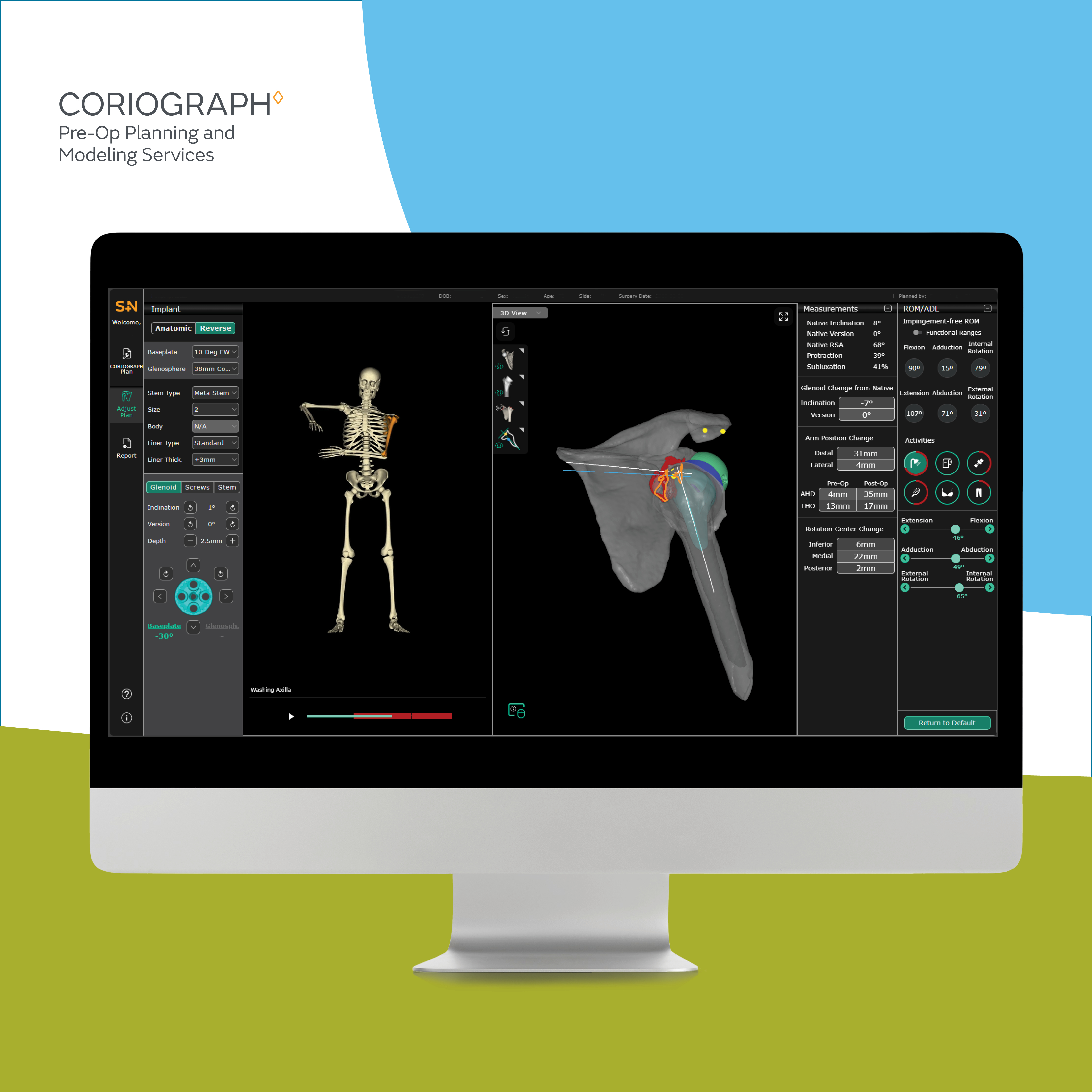 CORIOGRAPH