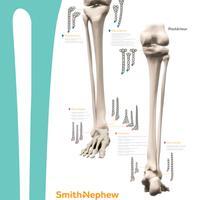 12348-fr V2 EVOS SMALL LE Skeleton Overview Poster 0919_HR