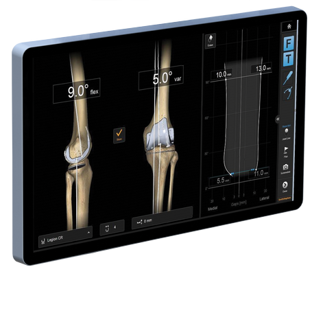 RI KNEE Navigation Hero 1.png