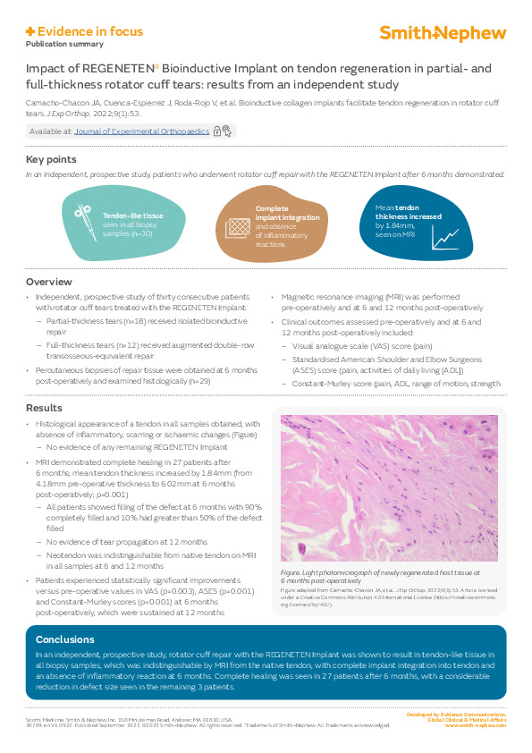 REGENETEN Evidence in Focus Camacho-Chacon