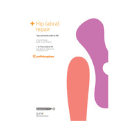 Hip labral repair: Tips and tricks with Q-FIX
