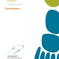 INVISIKNOT Syndesmosis Technique Guide