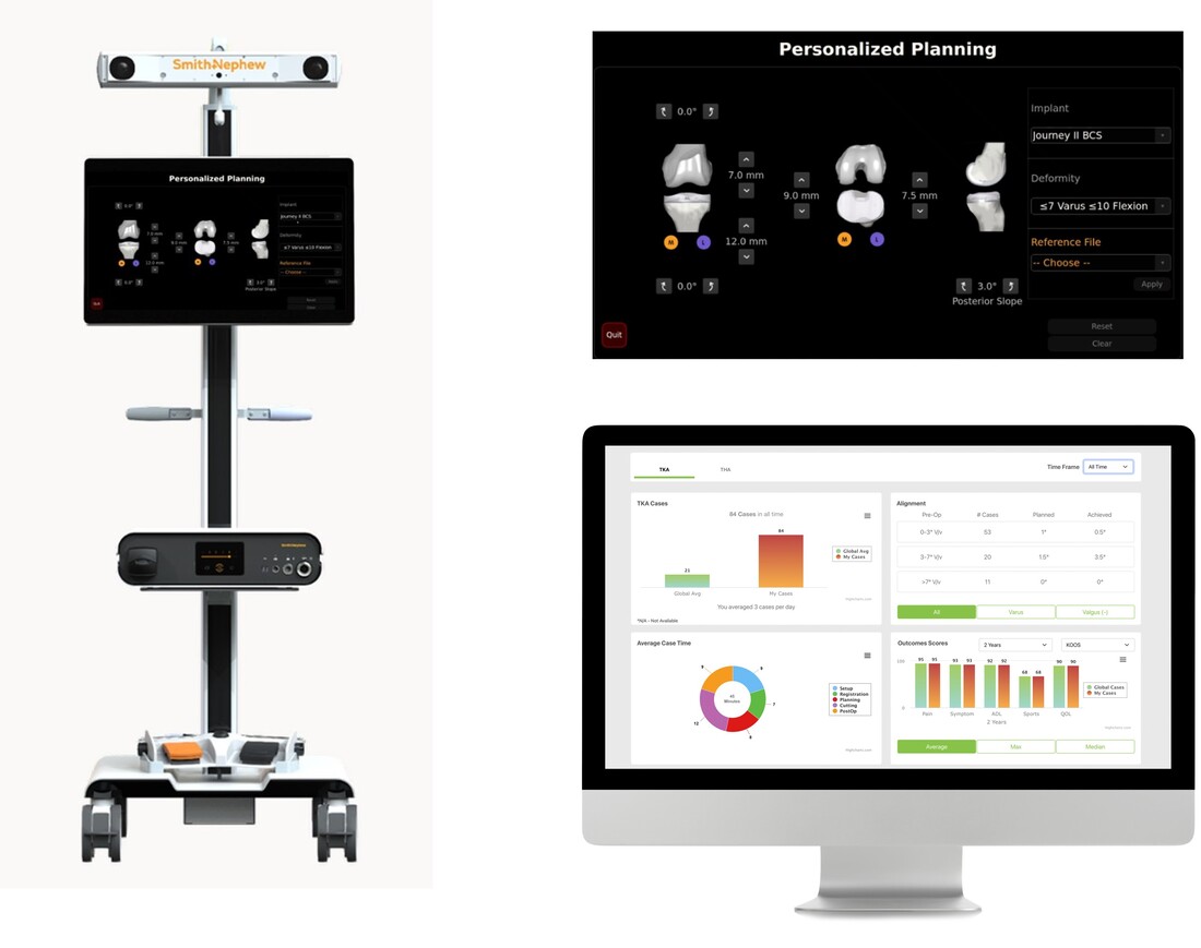 CORI robotic platform product image