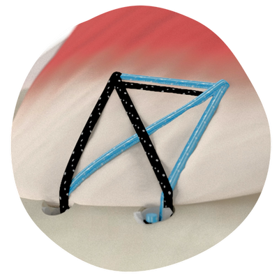 SHO-RCR-Anatomy (1) (1).png