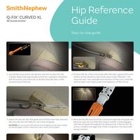 Q-FIX CURVED XL for Hip Reference Guide