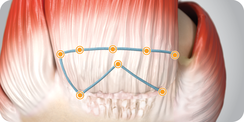 TENDON SEAM Flipbook 4 - Distributed load sharing