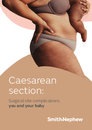 PICO patient booklet on c-section 
