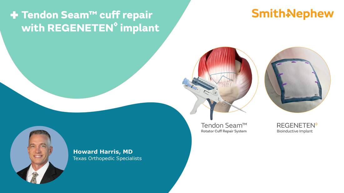 TENDON SEAM cuff repair with the REGENETEN Implant featuring Dr. Howard Harris