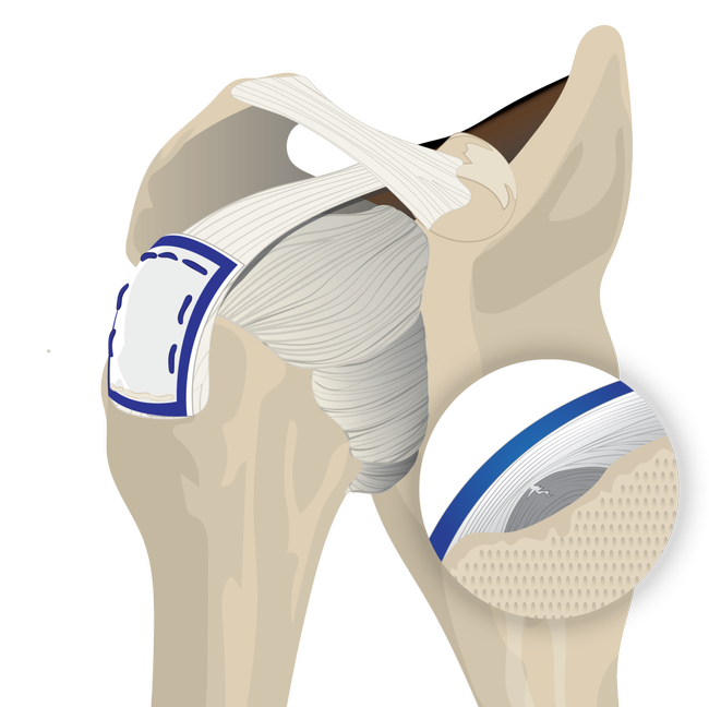 regeneten_placement.psd