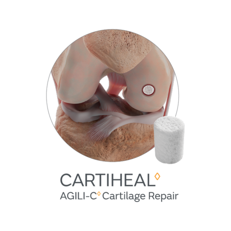 CARTIHEAL AGILI-C-Product Circle