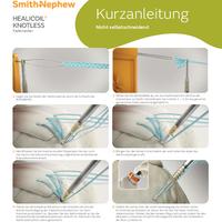 HEALICOIL Knotless non-self-tapping, OP-Technik Übersicht (22200-de)