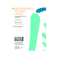 30315-anz-v1-mini-open-latarjet-double-endobutton-simovich-0322.pdf