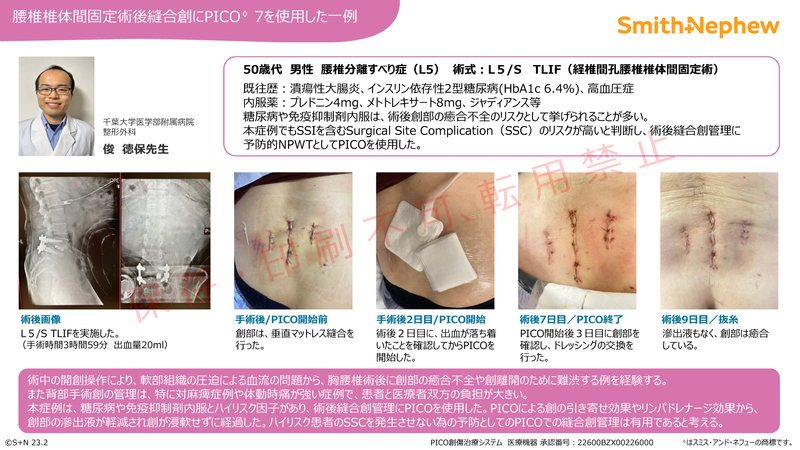 iPICO整形ケースカード_腰椎_俊先生.png
