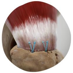 33747-V1-HIP-Hip-Preservation.png