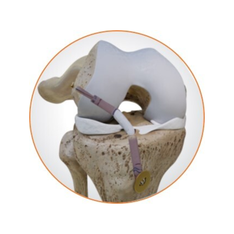 Reimagine reconstruction.jpg