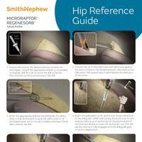 MICRORAPTOR REGENESORB for Hip Reference Guide