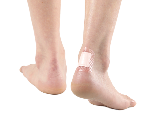 AWM_Shoe blister with AGBL.PNG