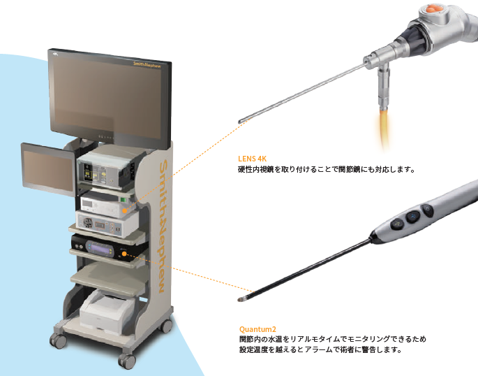Lumbar scope.PNG