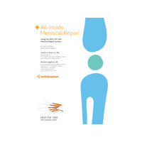 27046-V2-FAST-FIX-360-Technique-Guide-F-0422.pdf