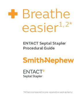 ENTACT Septal Stapler Procedural Guide