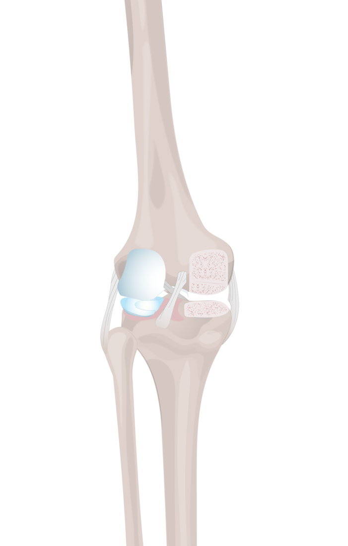 posterior uni anatomy and cuts.png