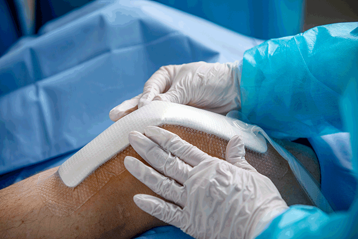Orthopedics | Possible with PICO