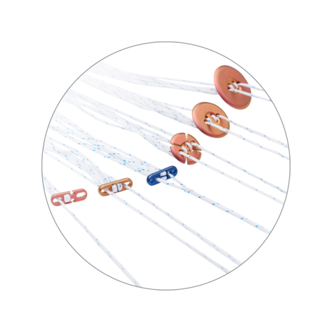 ULTRABUTTON Adjustable Fixation Device Family | Smith+Nephew Global