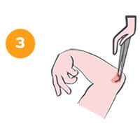 Icon - Consumer - Elbow return skin tear to position