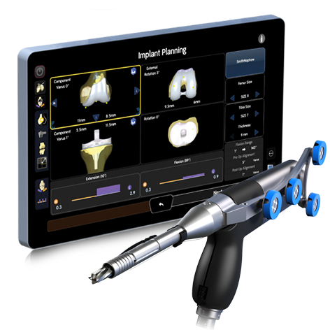 CORI TKA tablet handpiece no background Product Hero.png