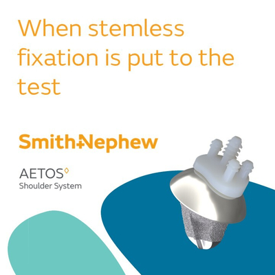 47855 V1 AETOS Stemless EiF Blog Graphic Thumbnail 0426.jpg