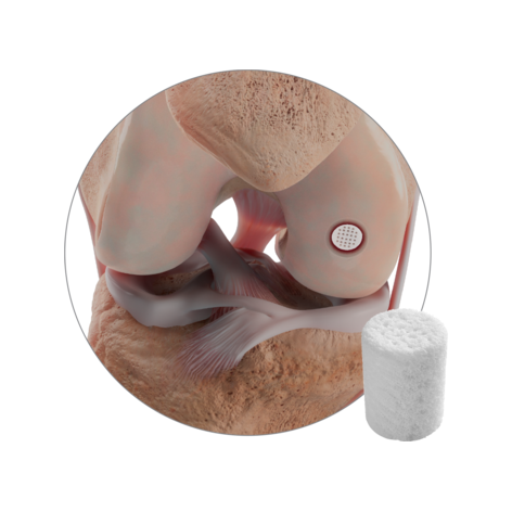 41813 CARTIHEAL Product Page Hero Image V2